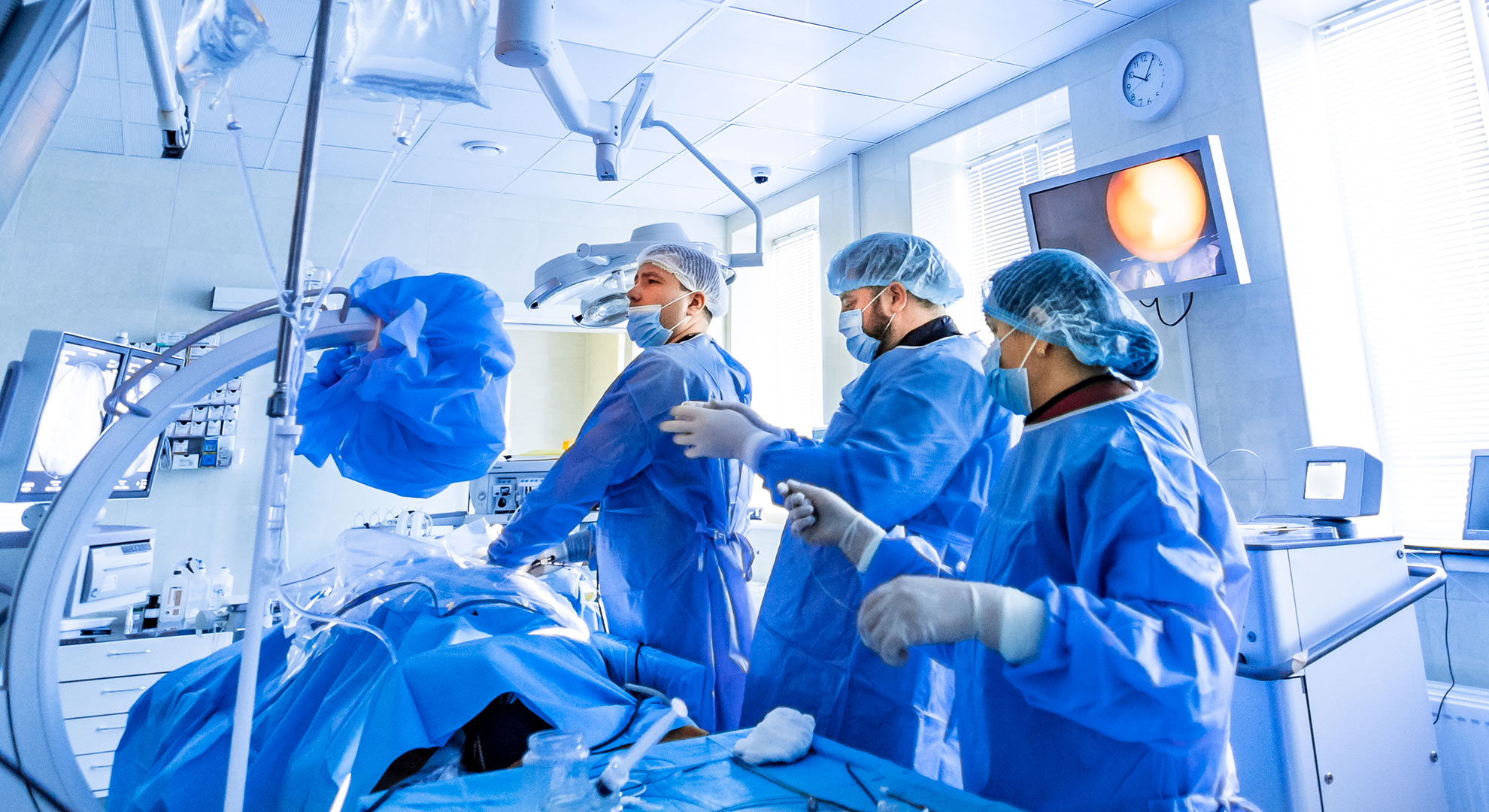 Air purification in operating rooms